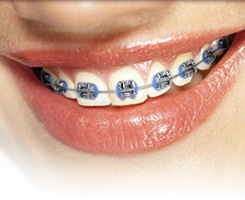 https://baselineortho.com/wp-content/uploads/2020/12/metal_color.png