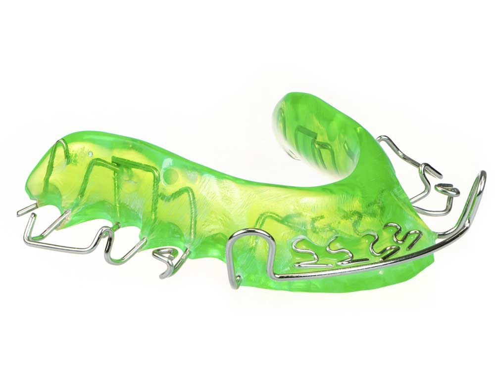 Removable orthodontic retainer used to maintain teeth alignment after braces